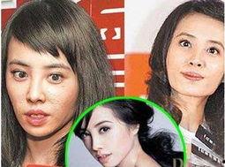 某整形医生爆料新闻视频,揭秘整形手术背后的真相 第3张 某整形医生爆料新闻视频,揭秘整形手术背后的真相 第3张